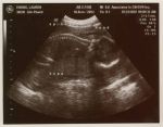 Baby Eric Ultrasound at Minus 4 Months